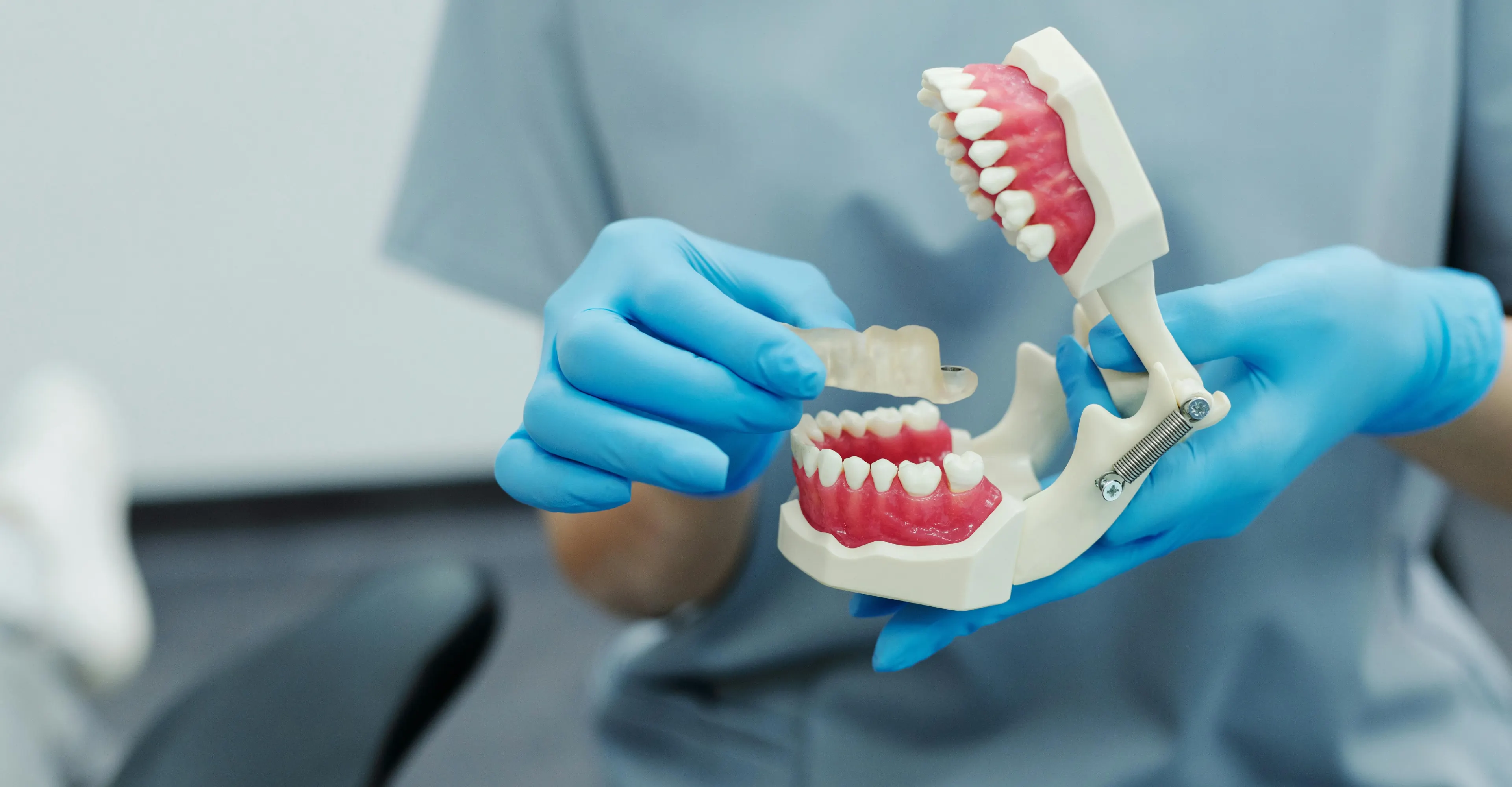 High-quality dental crown restoration